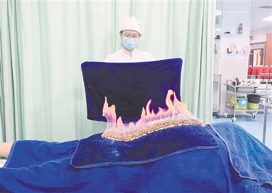 医护人员为患者进行火龙灸温补肾阳。 医护人员为患者进行火龙灸温补肾阳。
