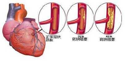 哪些食物对心脏有疗效 408d5cb4c7b71e0520b15d.jpeg