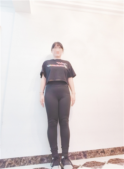 高女士减脂前后对比。