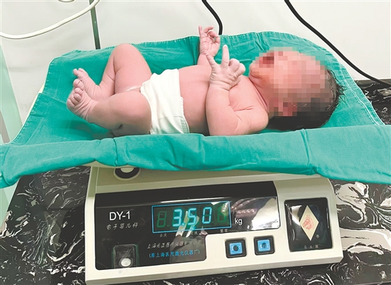宝宝体重3.5公斤，各项指标正常。